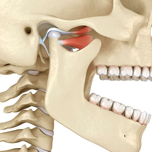 disfunção temporomandibular